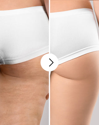 Cápsulas para eliminar la celulitis y mejorar la calidad de la piel con extractos naturales Cellinea 60 cápsulas_3 - 3