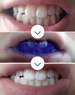 Corrector del color dental White Bite Smilebite 30 ml - 3