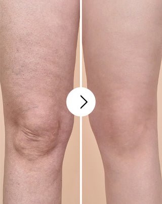 Cápsulas para eliminar la celulitis y mejorar la calidad de la piel con extractos naturales Cellinea 60 cápsulas - 3