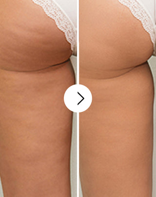 Cápsulas para eliminar la celulitis y mejorar la calidad de la piel con extractos naturales Cellinea 60 cápsulas - 4