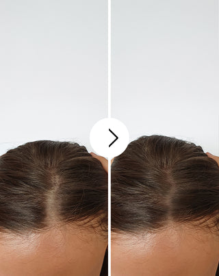 Cápsulas para reducir la caída del cabello, fortalecerlo y espesarlo salud Follixin 60 cápsulas