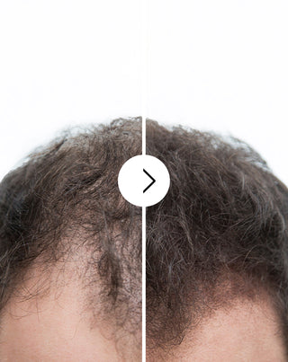 Cápsulas para reducir la caída del cabello, fortalecerlo y espesarlo salud Follixin 60 cápsulas
