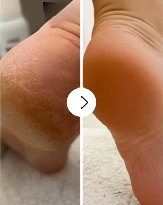 Crema de pies suavizante Nutridome con urea y manteca de karité - 4