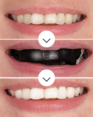 Tiras blanqueadoras de dientes The White(ning) Stripes Smilebite - set de 28 unidades - 3