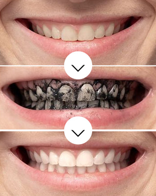 Polvo blanqueador dental con carbón activado de coco Smilebite