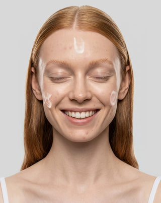 Crema de día antiacné con ácido salicílico y ácido azelaico para imperfecciones Anti-Acne Orphica Clinic 50 ml - 2